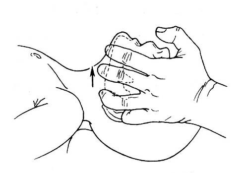 (托颌法-双手)建立呼吸也就是我们经常说的口对口人工呼吸.