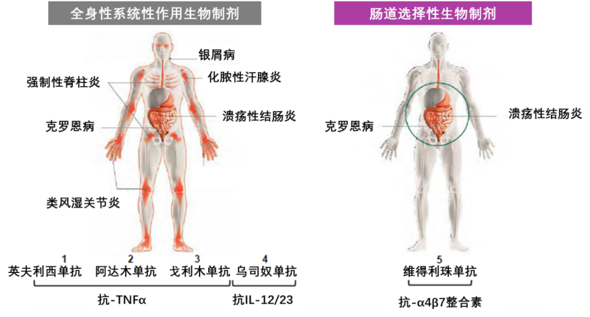 准确识别获益更高的患者 新武器 实践克罗恩病个体化治疗 腾讯新闻