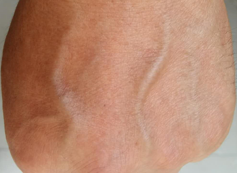 为何有人手上的青筋凸起这说明身体差吗