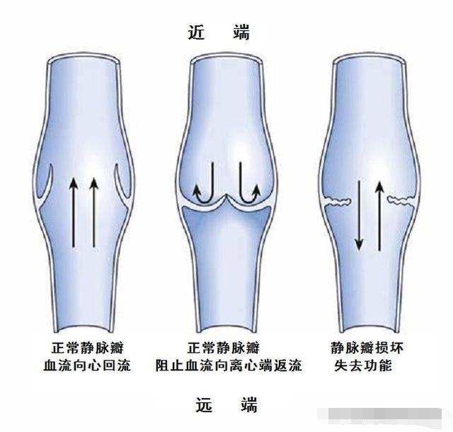 静脉瓣作用图片