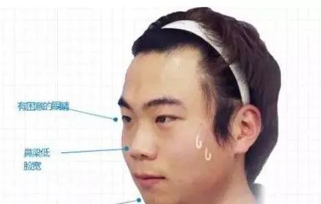 穷命面相典型小人