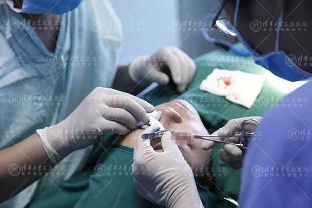 解答】如何判断自己的眼睛是提肌无力?