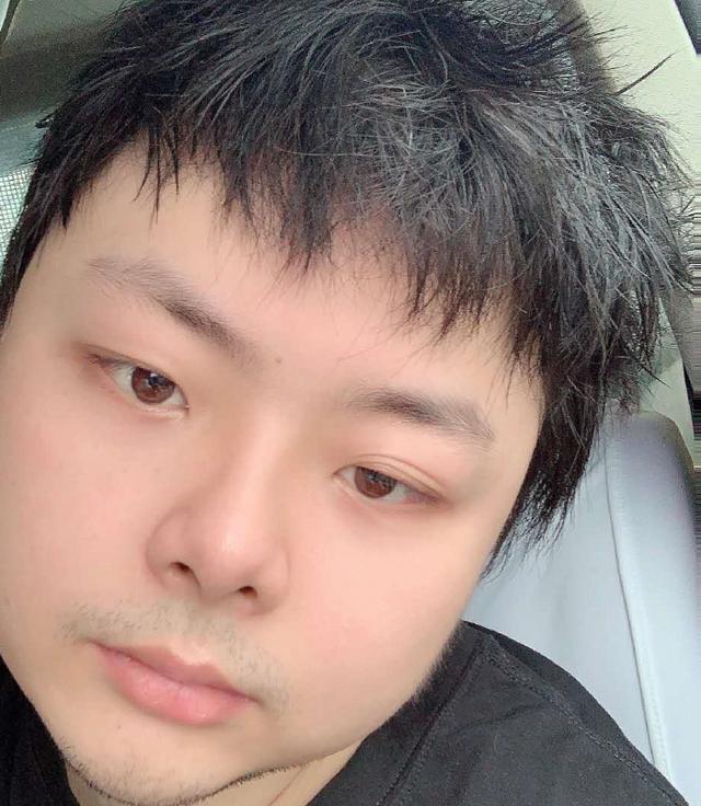 德云色西卡抽脂是真的吗？德云色抽脂事件是怎么回事？