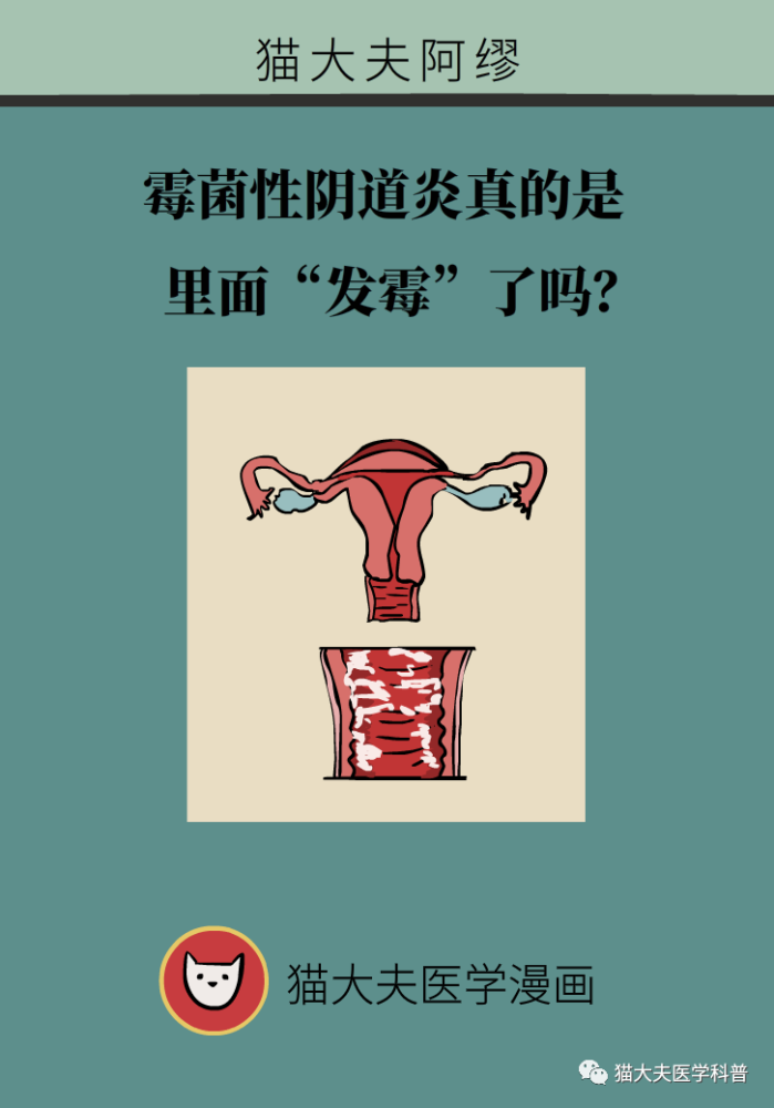 霉菌性阴道炎手把手教你抗霉大法