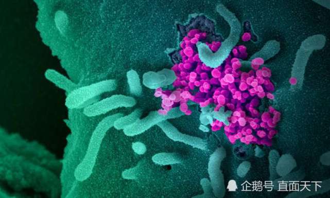 cnn指出,美国洛斯·阿拉莫斯国家试验室也曾在4月份强调,"d614g"变异