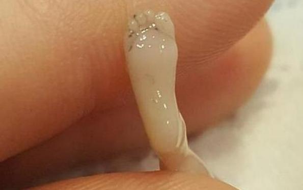 人工流产的胎儿最后去哪了看了这些安置方式你还会打胎吗