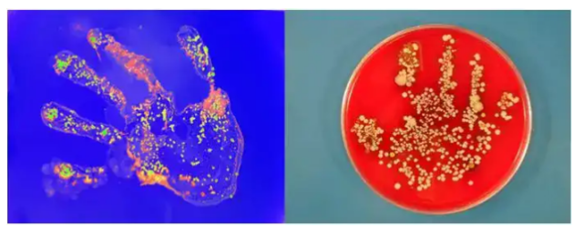 图1显示的是未经清洗的手,把手掌在细菌培养基里按一下,然后培养一夜