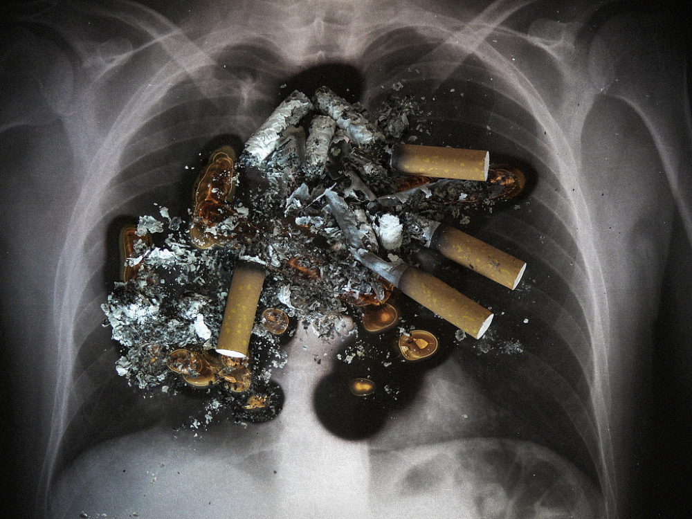 戒烟后被熏黑的肺还能白回来吗患癌症的几率会不会下降