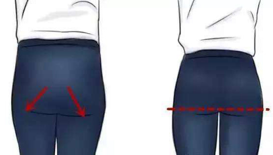 长期久坐形成"妈妈臀",显老又难看怎么办?这组动作解决问题!