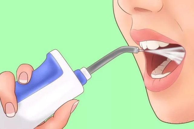 去除扁桃体结石 让你轻松一口气 喉咙 扁桃体结石 漱口水