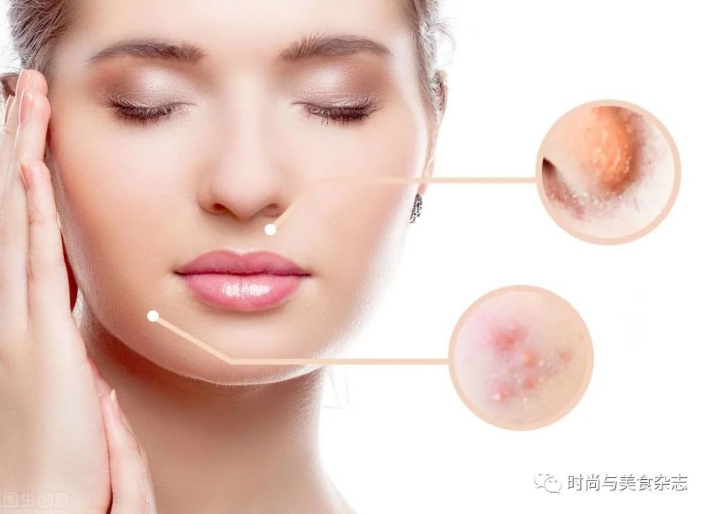 油性敏感肌肤这样护理竟然变得靓丽嫩白抗过敏