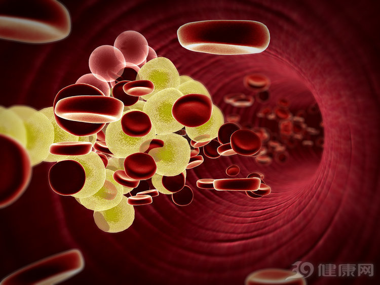 血管|血管好，寿命长：4个表现反映血液粘稠程度，50岁以上都要自查