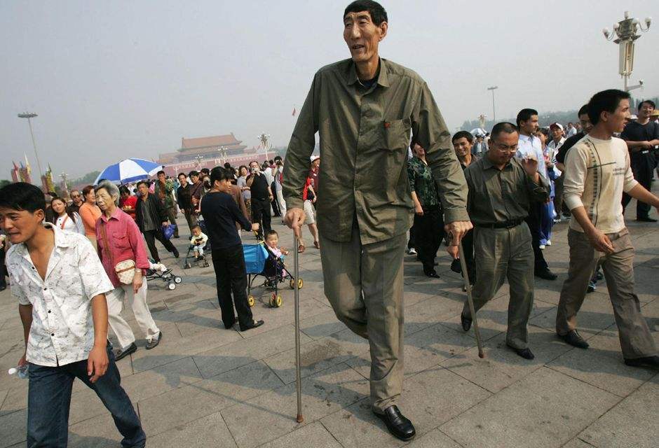 中国巨人喜获一子为何医生却建议不要生出来说出来你可能不信