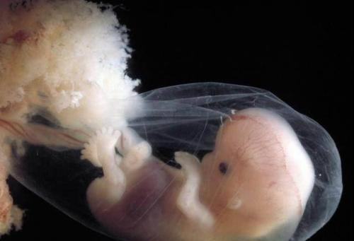 两个月的胚胎图片真实图片