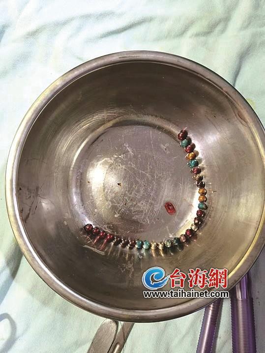 孩子误食磁力珠一颗能不能排出_小孩子误食一颗磁力球要紧吗多久能排出