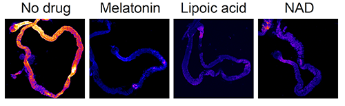 睡眠|不睡觉为何会死掉？睡眠、死亡与肠道之间的神秘联系