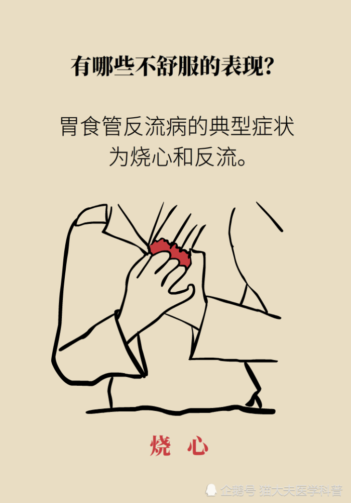 胃食管反流|胃食管反流很烧心，预防要做好这三方面