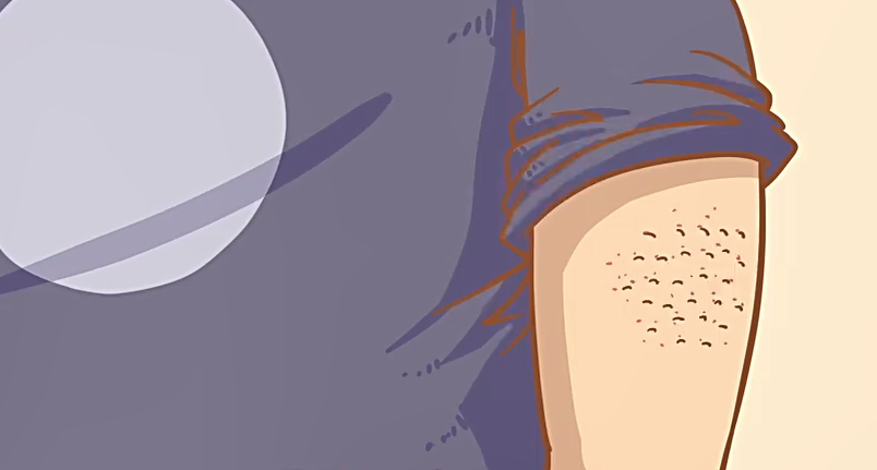 每天总是起鸡皮疙瘩怎么办(每天总是起鸡皮疙瘩怎么办呢)