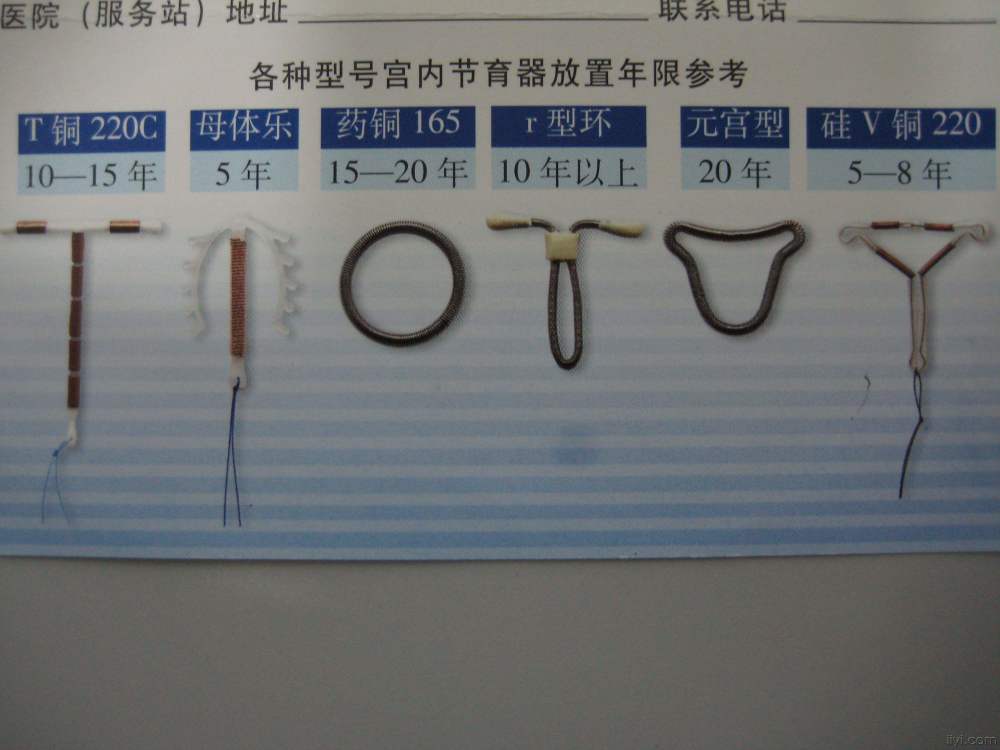 首批"上环"的女性已步入中老年,3种不同的结局,有些令人心疼_腾讯新闻