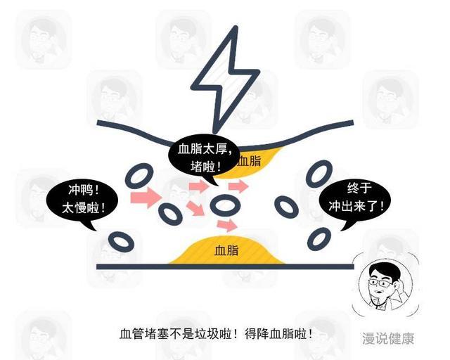 中风|上半身一处血管最怕堵塞，是中风的“加速器”！学会4招帮你预防