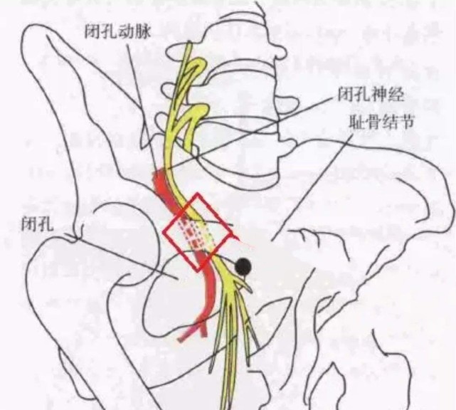 下肢|股骨头|膝关节|闭孔神经|髋关节