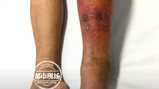 突然下雨,只好蹚水赶路,可到公司后因为没有备用鞋袜,只能穿着湿袜子