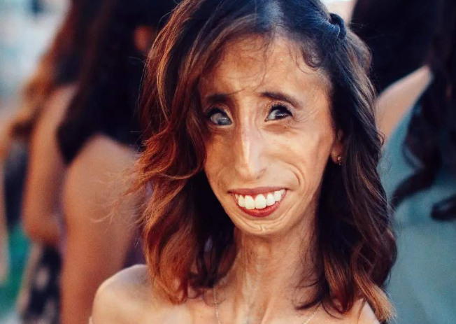 世界最丑的女人,被多位帅哥追求,男人因追不到她伤心懊悔!_腾讯新闻