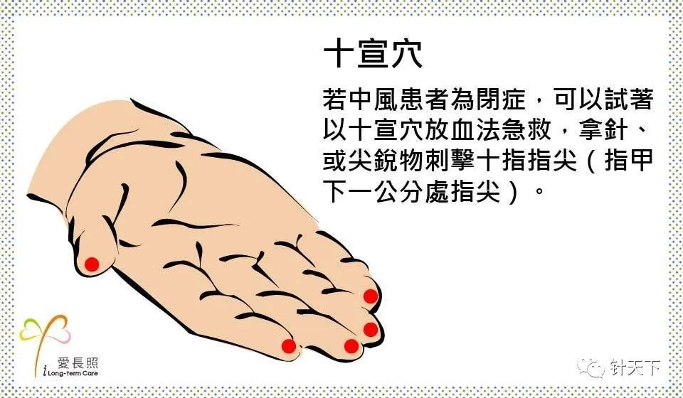 中风急救不简单_腾讯新闻