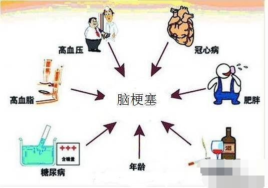 现在四十五岁左右得脑梗的人为什么那么多?