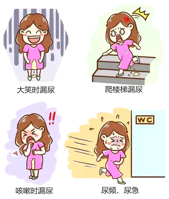 笑尿了,可能是一种病!专家提醒:尿失禁可防,可控,可治