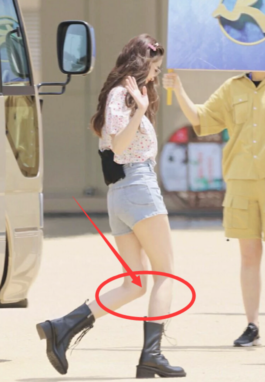 baby减肥过度一走路膝盖弯出直角形看看都瘦成什么样了