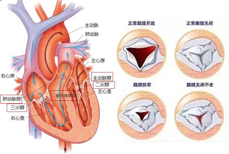 心脏瓣膜病视图图片