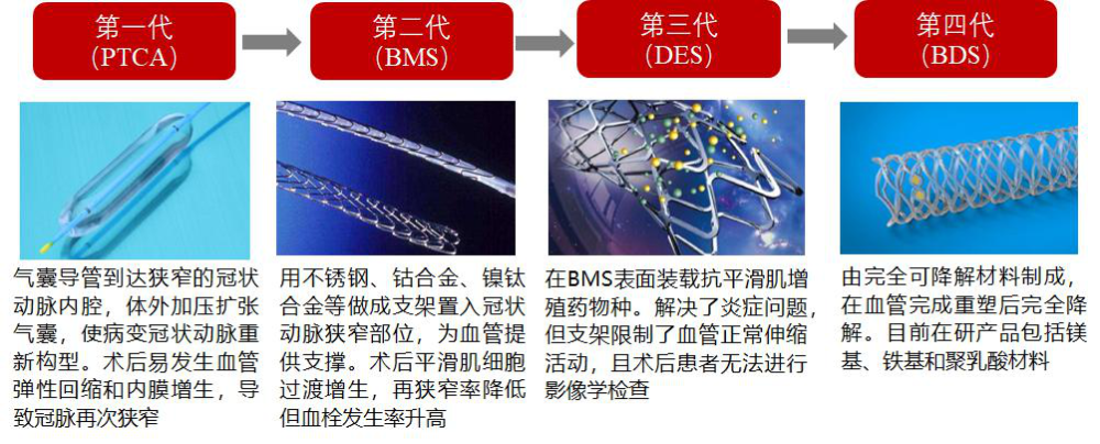 第二代金屬裸支架基本已被淘汰,第三代藥物洗脫支架植入率已達到99%