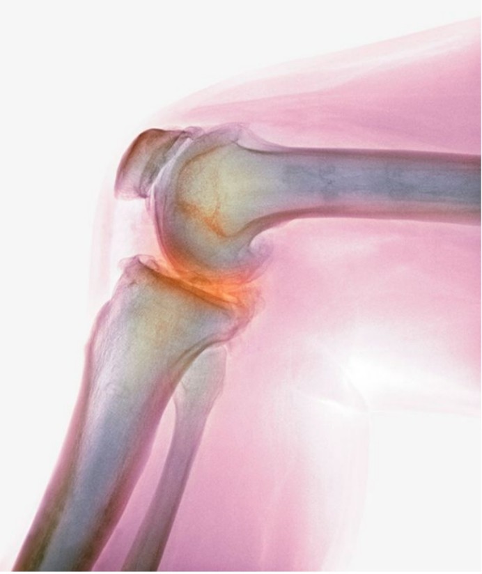 人类进化过程中淘汰的器官,又重新长了回来,我们的身体在退化?