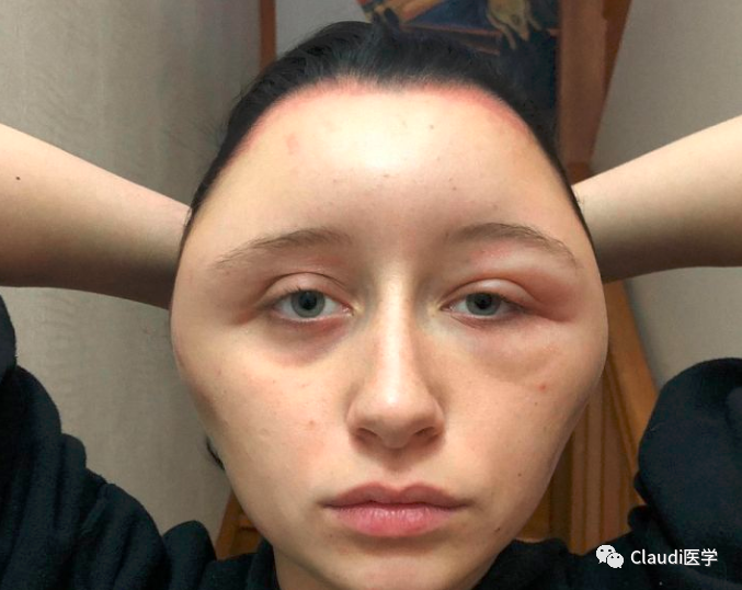 看了她们变形的脸后我决定再也不染发了