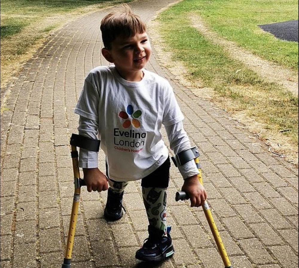 英5岁男孩被父母虐待双腿截肢,靠假肢走10公里募捐感谢医院