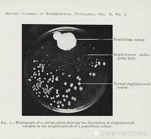 被科学耽搁的亚历山大:发现青霉菌不被重视,微生物作画流传至今