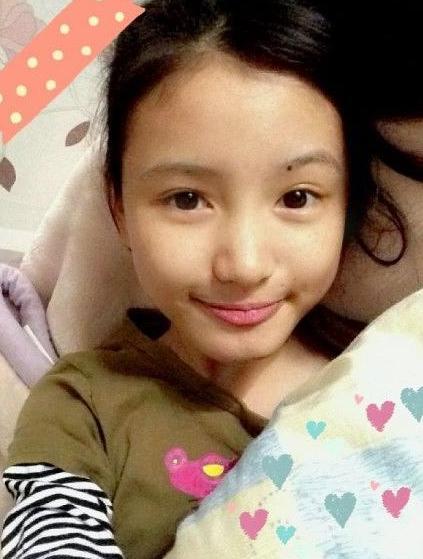 林小宅旧照近照对比,"屁股下巴"变尖疑整容,早年回应纯原装