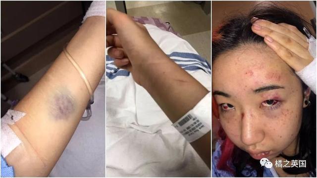 布朗宁将这名女生双手拷在背后,从房间一直拖到电梯,再到大厅,还给了