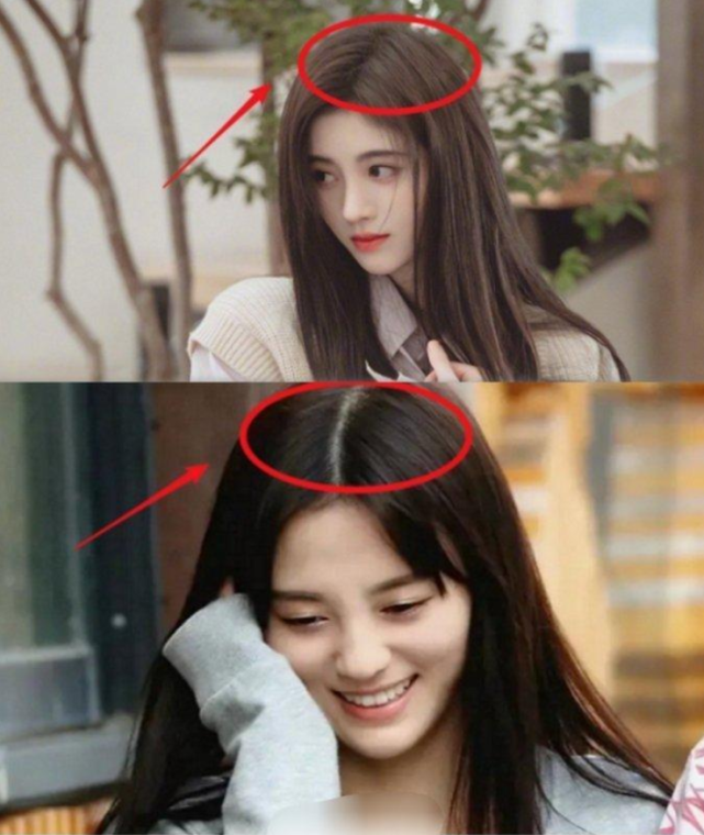 鞠婧祎频频被质疑戴假发植发,当把镜头放大十倍,头发缝说明一切