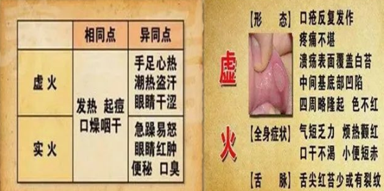 虚火上炎 腾讯网
