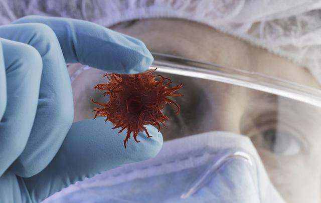 晚期肿瘤治疗困难目前还没有一下子就可以治好肿瘤的药物问世