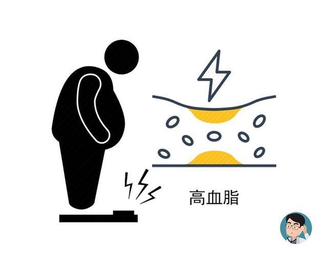 肥胖|肥胖又添新罪名？9000万中国胖子，这3个疾病很难“避开”！