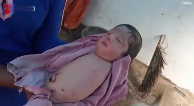 印度28岁女子生下一女婴 孩子竟然没有四肢