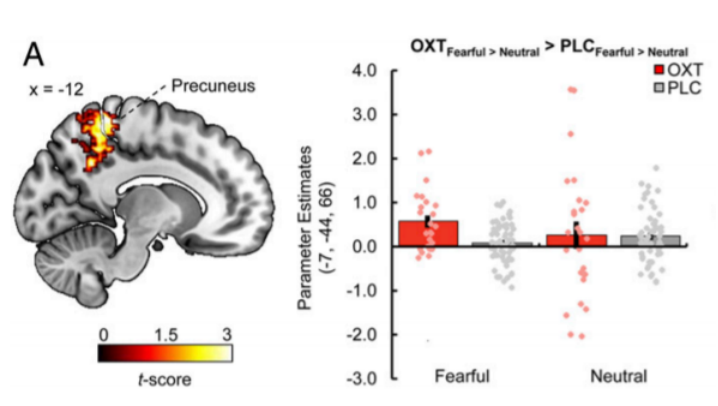 淋巴|当前关于大脑淋巴系统的争议