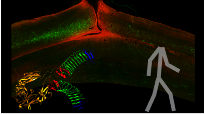 淋巴|当前关于大脑淋巴系统的争议