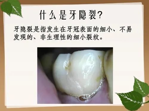 "医生,我左边的大板牙好疼,昨晚疼了一宿.