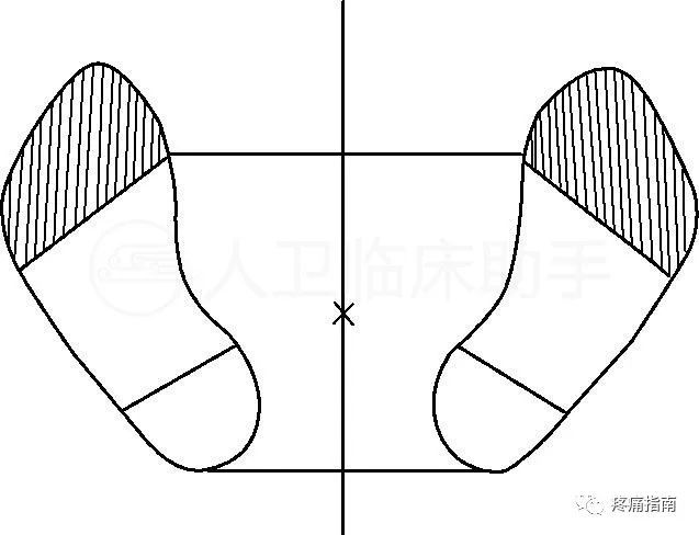 查体步态检查 腾讯新闻