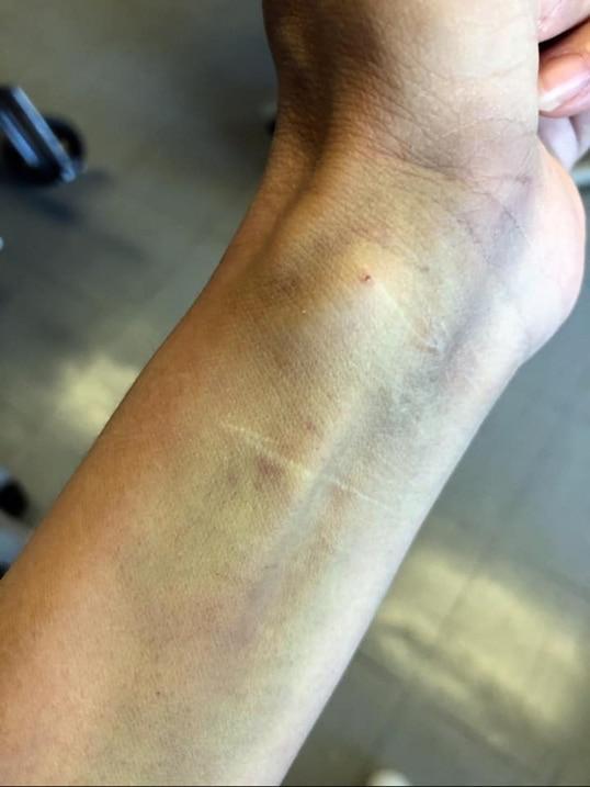 香港女星患厌食症入icu,鬓边白发明显针孔黑青,曾与梁朝伟合作