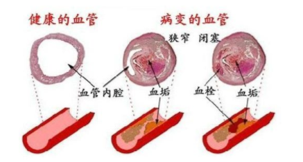 糖尿病并发症|自愈力恢复，逆转糖尿病并发症，科研创新成果有望实现